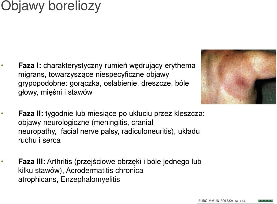 kleszcza: objawy neurologiczne (meningitis, cranial neuropathy, facial nerve palsy, radiculoneuritis), układu ruchu i