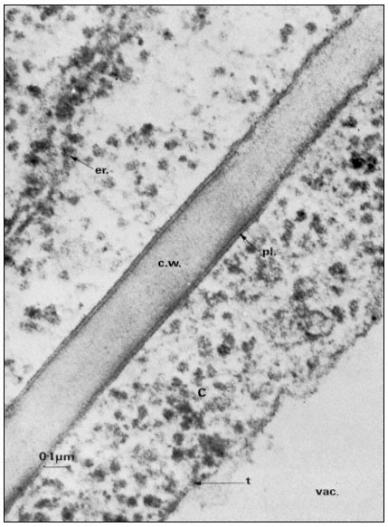 Błona komórkowa - plazmalemma Znajduje się tuż pod ścianą komórkową. Otacza półprzeźroczystą galaretowatą substancję cytoplazmę.