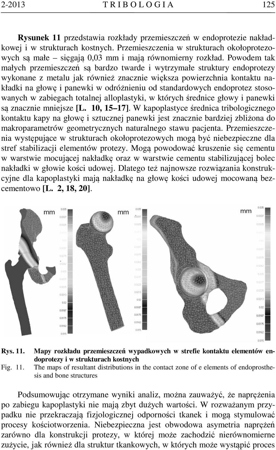 Powodem tak małych przemieszczeń są bardzo twarde i wytrzymałe struktury endoprotezy wykonane z metalu jak również znacznie większa powierzchnia kontaktu nakładki na głowę i panewki w odróżnieniu od