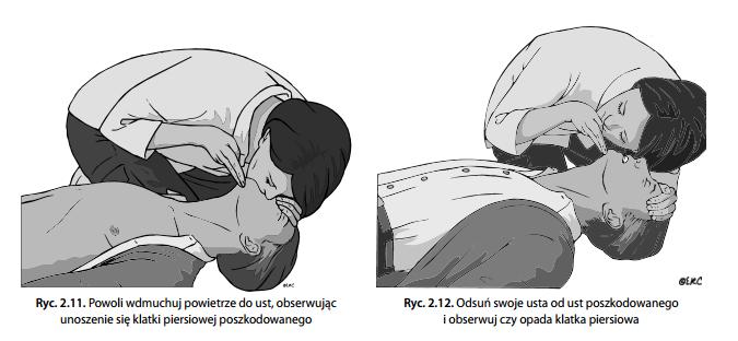 Odchyl głowę, unieś żuchwę, zaciśnij skrzydełka nosa, weź normalny wdech i obejmij szczelnie usta poszkodowanego swoimi ustami, upewniając się, że nie ma przecieku powietrza, wdmuchuj powietrze do