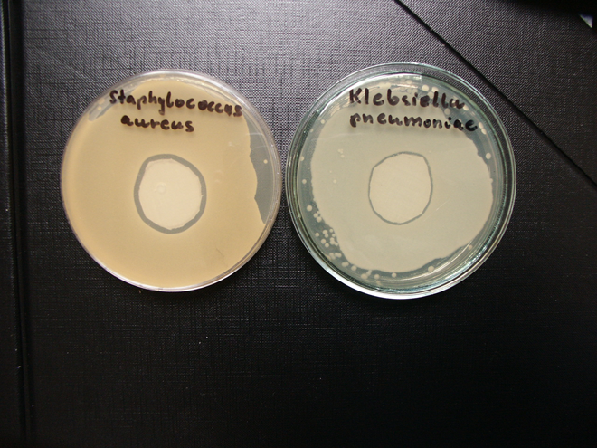 Nr 2 Ocena mikrobiologiczna materia³ów w³ókienniczych antybakteryjnych 181 Ryc. 4.