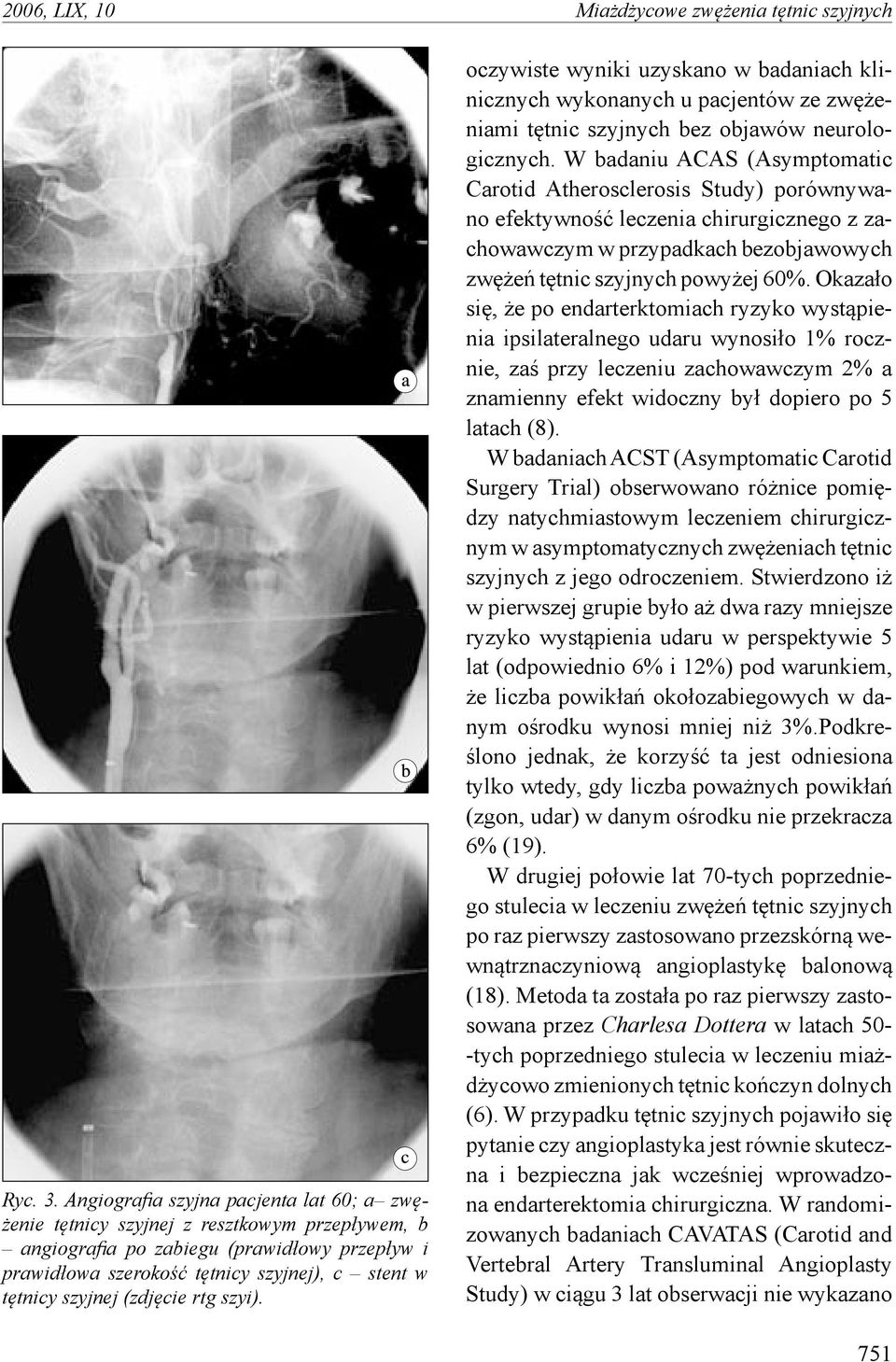 szyjnej (zdjęcie rtg szyi). oczywiste wyniki uzyskano w badaniach klinicznych wykonanych u pacjentów ze zwężeniami tętnic szyjnych bez objawów neurologicznych.