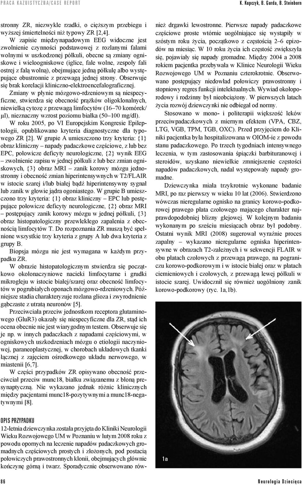 fali ostrej z falą wolną), obejmujące jedną półkulę albo występujące obustronnie z przewagą jednej strony. Obserwuje się brak korelacji kliniczno-elektroencefalograficznej.