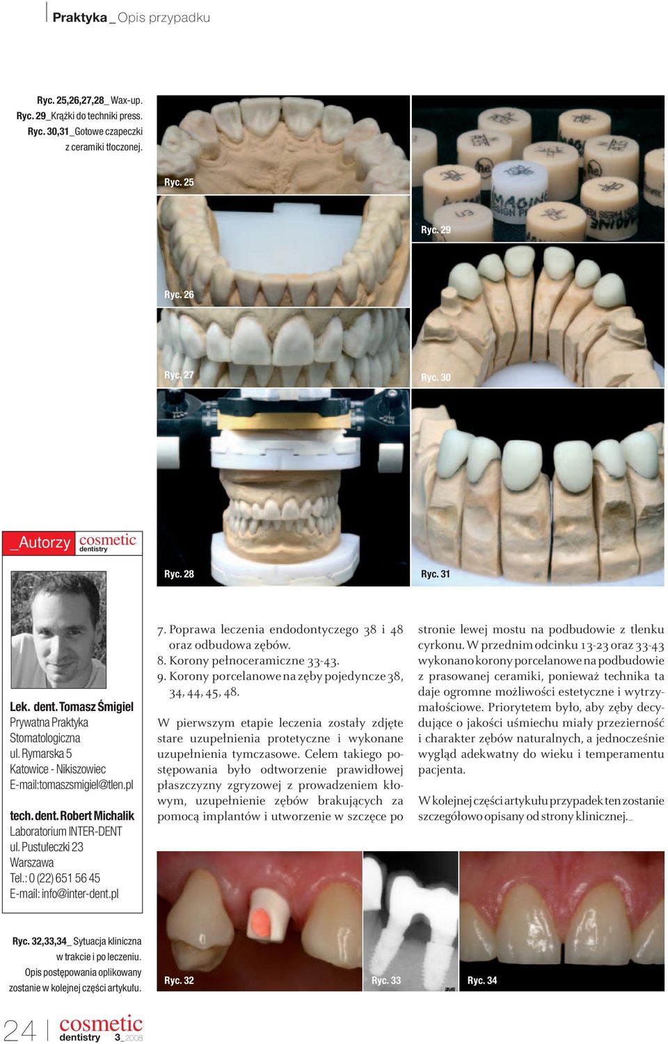 Pustu eczki 23 Warszawa Tel.:0 (22) 651 56 45 E-mail: info@inter-dent.pl 7. Poprawa leczenia endodontyczego 38 i 48 oraz odbudowa zębów. 8. Korony pełnoceramiczne 33-43. 9.