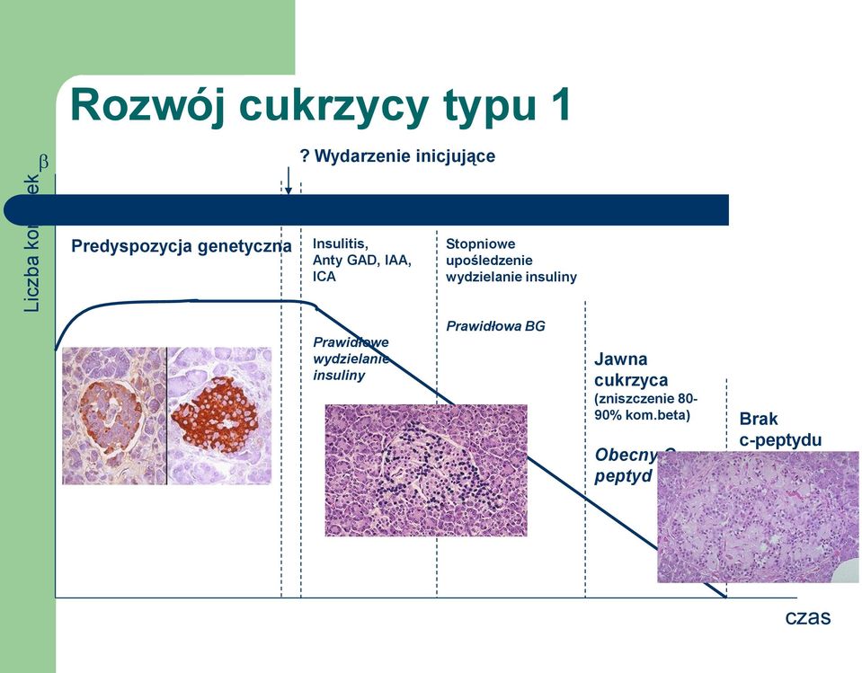 Stopniowe upośledzenie wydzielanie insuliny Prawidłowe wydzielanie insuliny