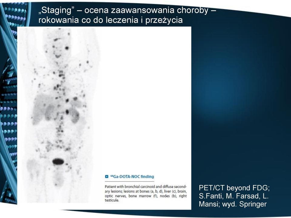 i przeżycia PET/CT beyond FDG; S.