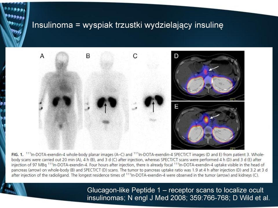 Peptide 1 receptor scans to localize