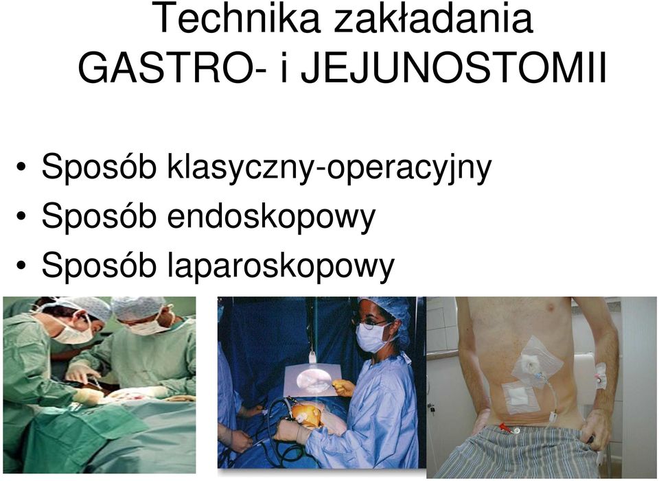 klasyczny-operacyjny Sposób