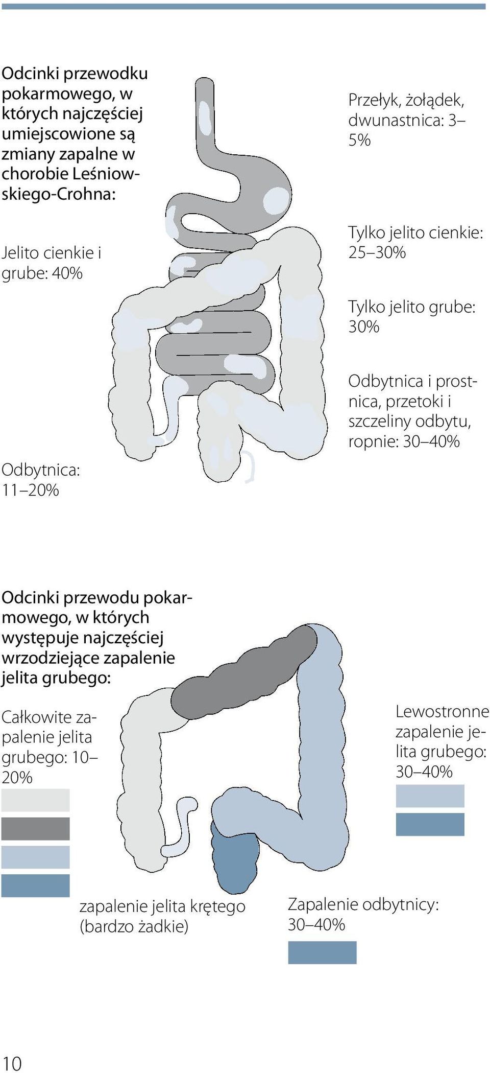 szczeliny odbytu, ropnie: 30 40% Odcinki przewodu pokarmowego, w których występuje najczęściej wrzodziejące zapalenie jelita grubego: Całkowite