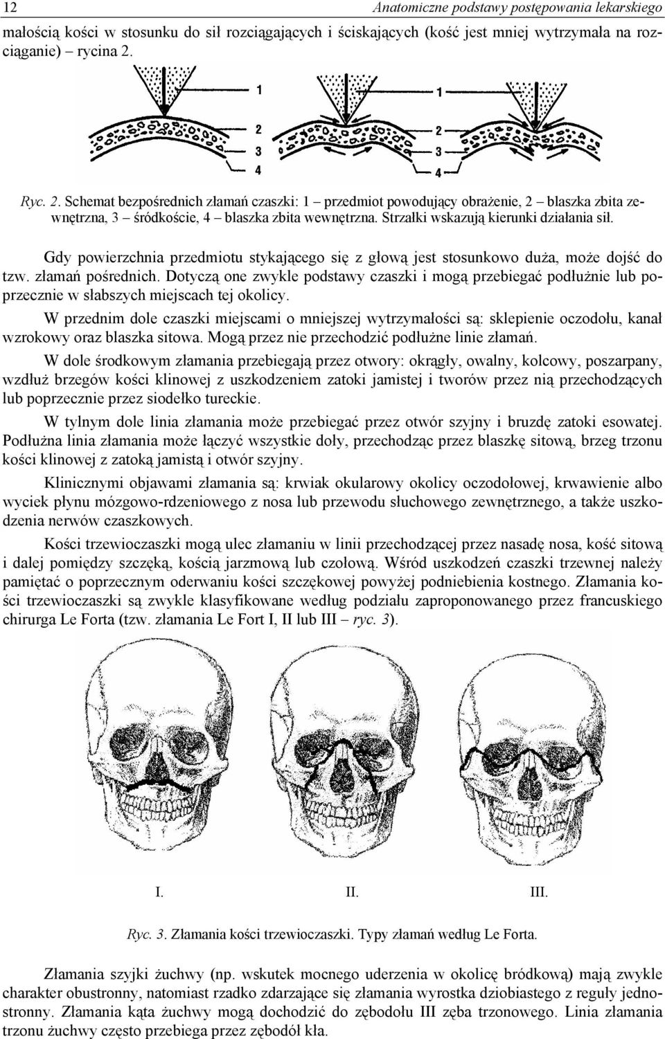 Gdy powierzchnia przedmiotu stykającego się z głową jest stosunkowo duża, może dojść do tzw. złamań pośrednich.