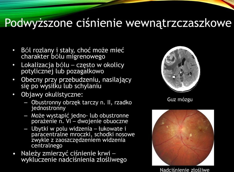 II, rzadko jednostronny Może wystąpić jedno- lub obustronne porażenie n.