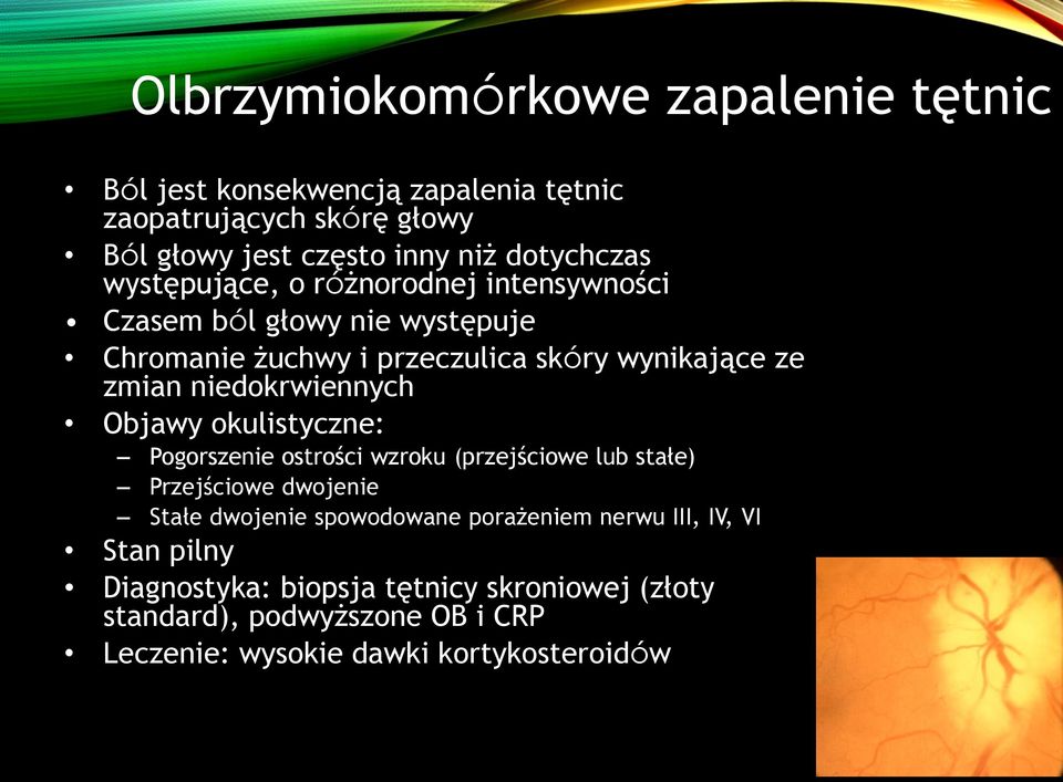 niedokrwiennych Objawy okulistyczne: Pogorszenie ostrości wzroku (przejściowe lub stałe) Przejściowe dwojenie Stałe dwojenie spowodowane