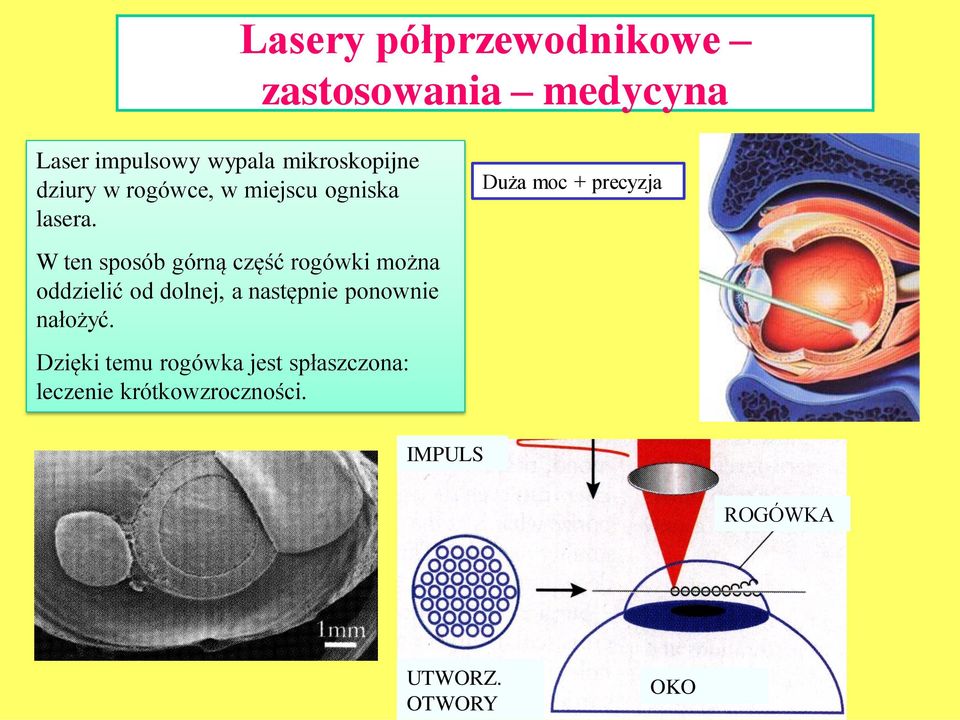 Duża moc + precyzja W ten sposób górną część rogówki można oddzielić od dolnej, a