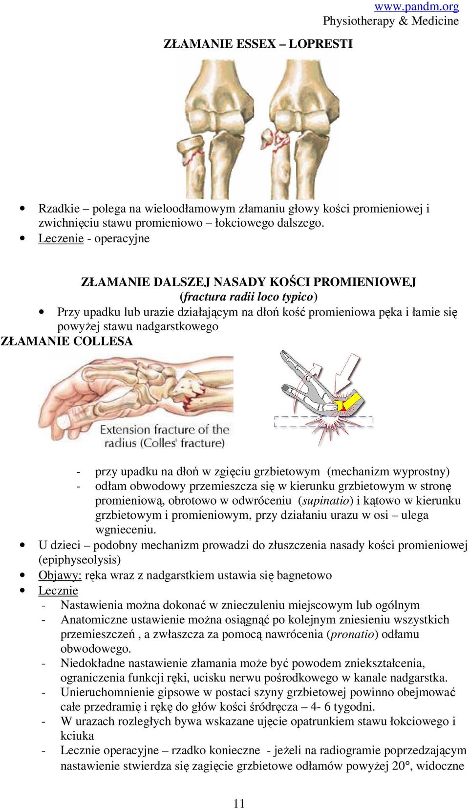 ZŁAMANIE COLLESA - przy upadku na dłoń w zgięciu grzbietowym (mechanizm wyprostny) - odłam obwodowy przemieszcza się w kierunku grzbietowym w stronę promieniową, obrotowo w odwróceniu (supinatio) i