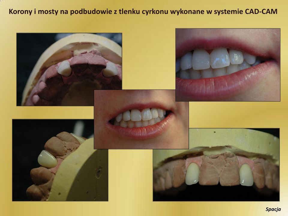 cyrkonu wykonane w