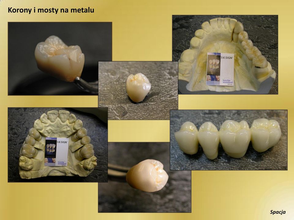 metalu