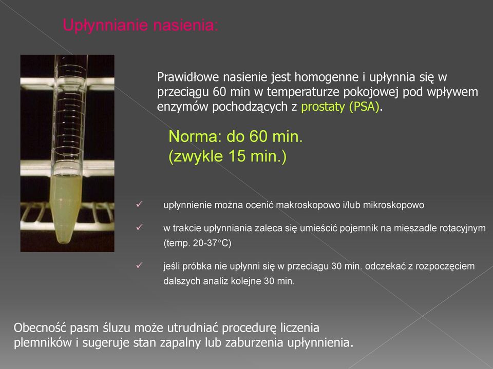 ) upłynnienie można ocenić makroskopowo i/lub mikroskopowo w trakcie upłynniania zaleca się umieścić pojemnik na mieszadle rotacyjnym (temp.