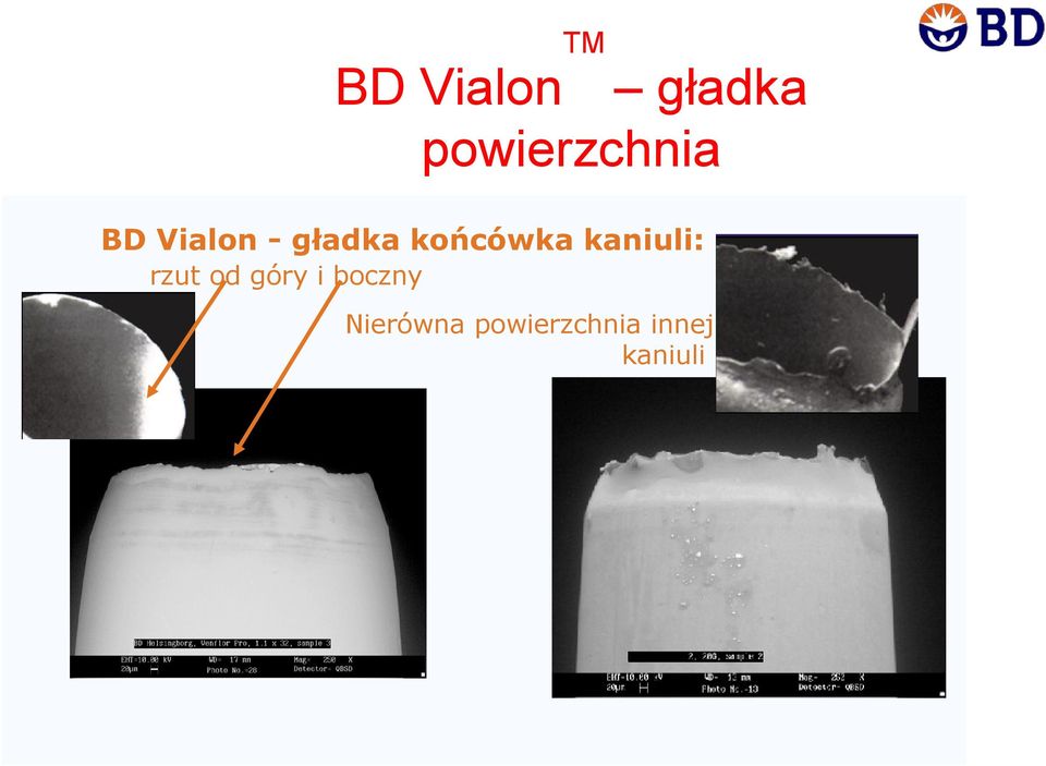 końcówka kaniuli: rzut od góry