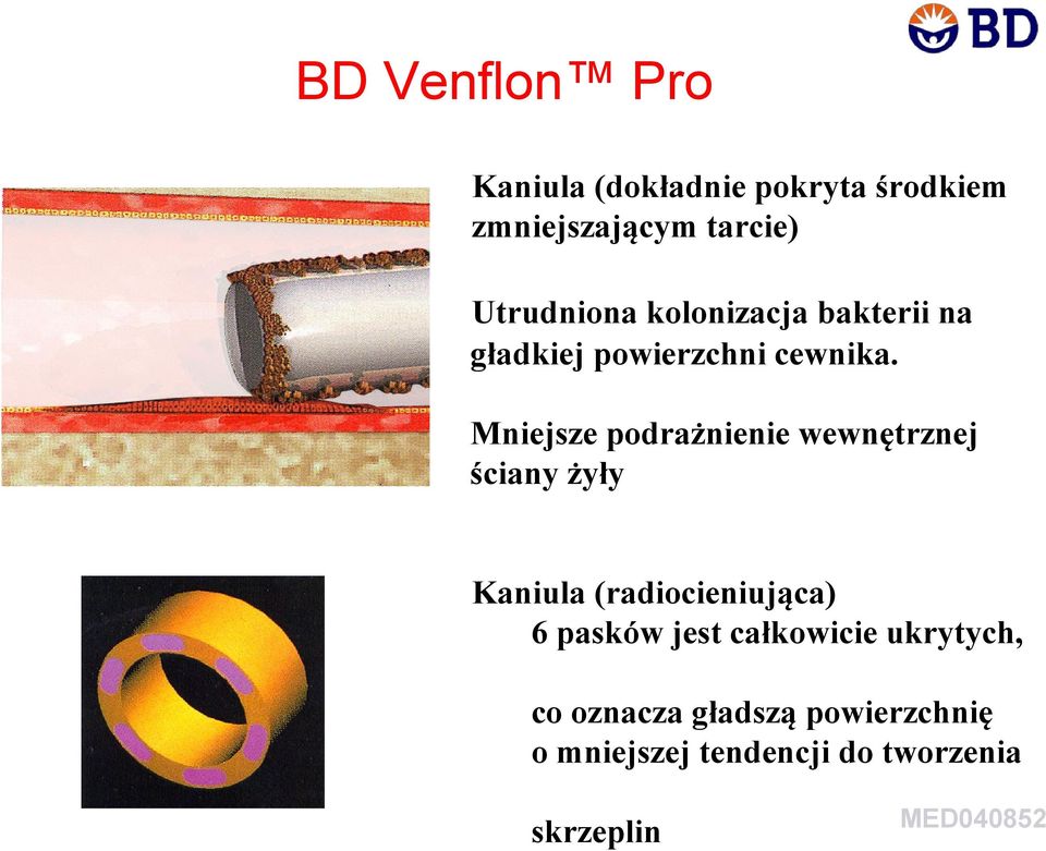 Mniejsze podrażnienie wewnętrznej ściany żyły Kaniula (radiocieniująca) 6 pasków