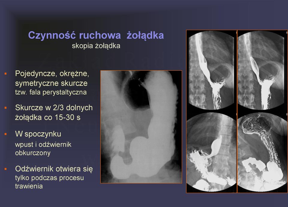 fala perystaltyczna Skurcze w 2/3 dolnych żołądka co 15-30 s