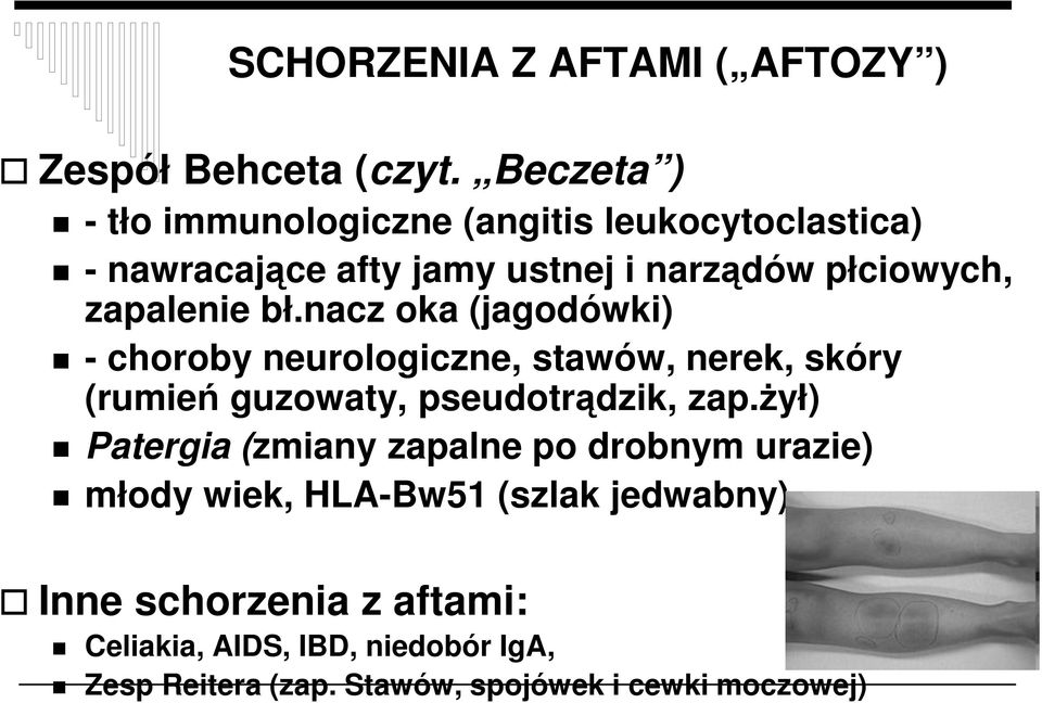 zapalenie bł.nacz oka (jagodówki) - choroby neurologiczne, stawów, nerek, skóry (rumień guzowaty, pseudotrądzik, zap.
