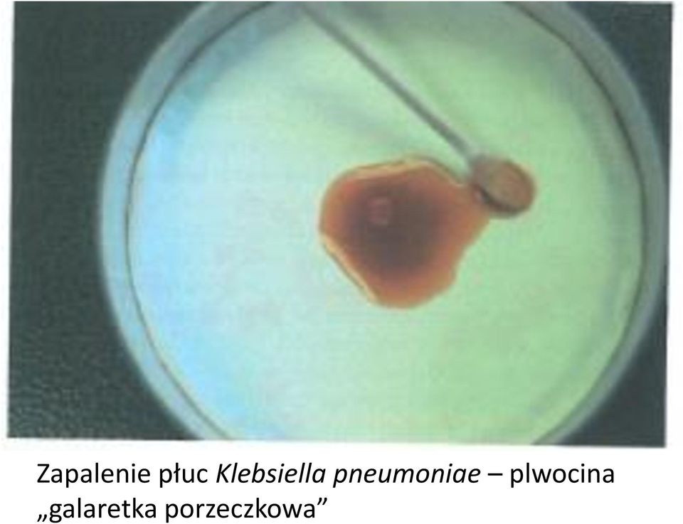 pneumoniae