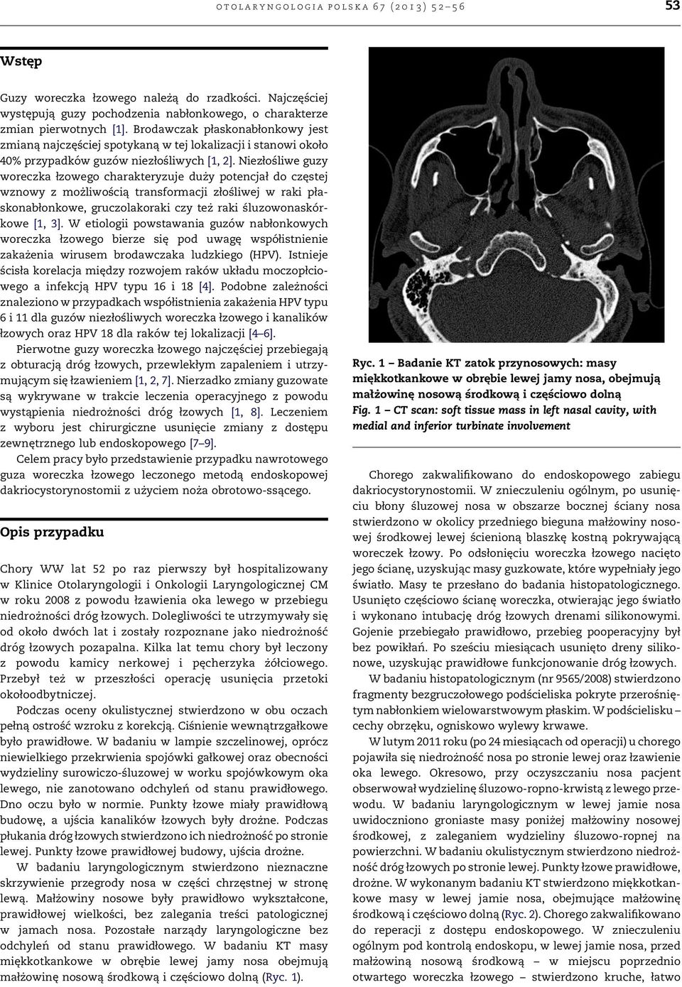 Niezłośliwe guzy woreczka łzowego charakteryzuje duży potencjał do częstej wznowy z możliwością transformacji złośliwej w raki płaskonabłonkowe, gruczolakoraki czy też raki śluzowonaskórkowe [1, 3].