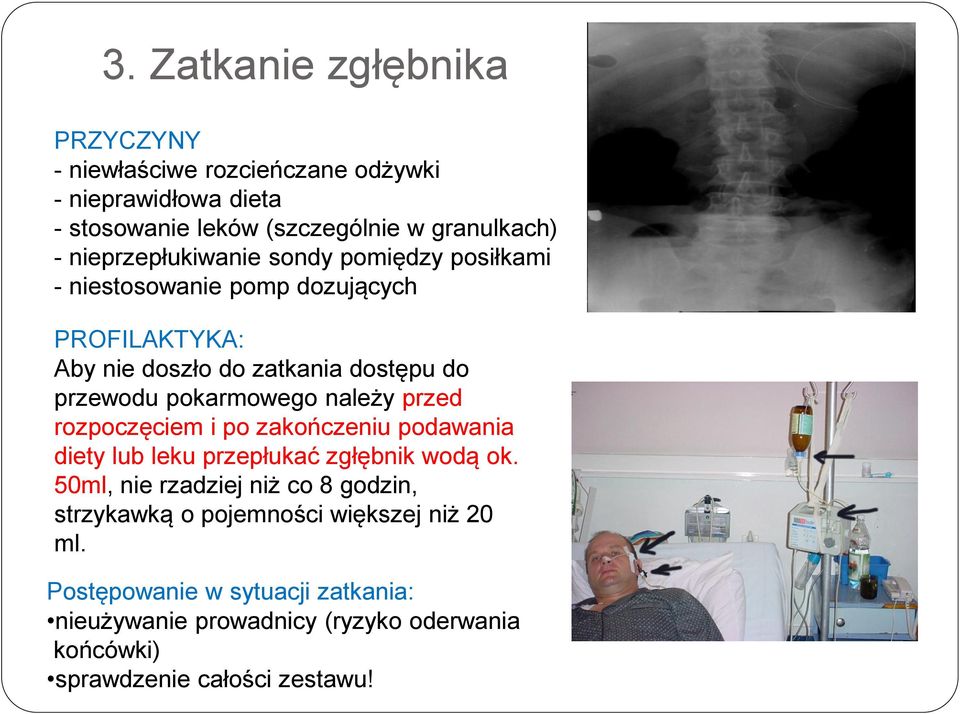 pokarmowego należy przed rozpoczęciem i po zakończeniu podawania diety lub leku przepłukać zgłębnik wodą ok.