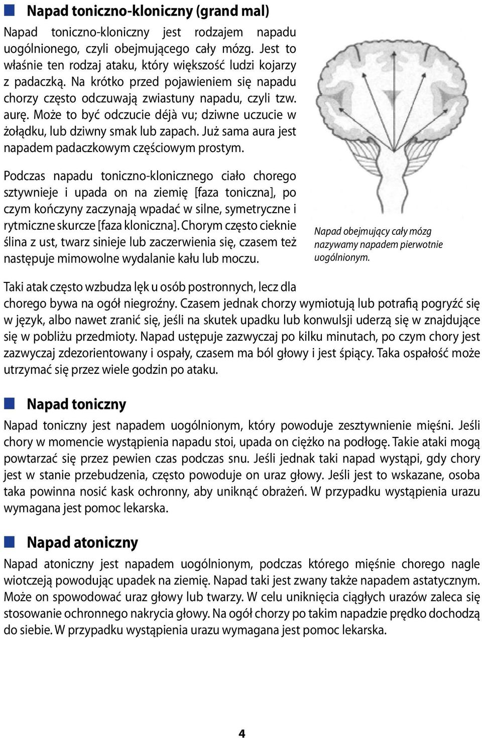 Może to być odczucie déjà vu; dziwne uczucie w żołądku, lub dziwny smak lub zapach. Już sama aura jest napadem padaczkowym częściowym prostym.
