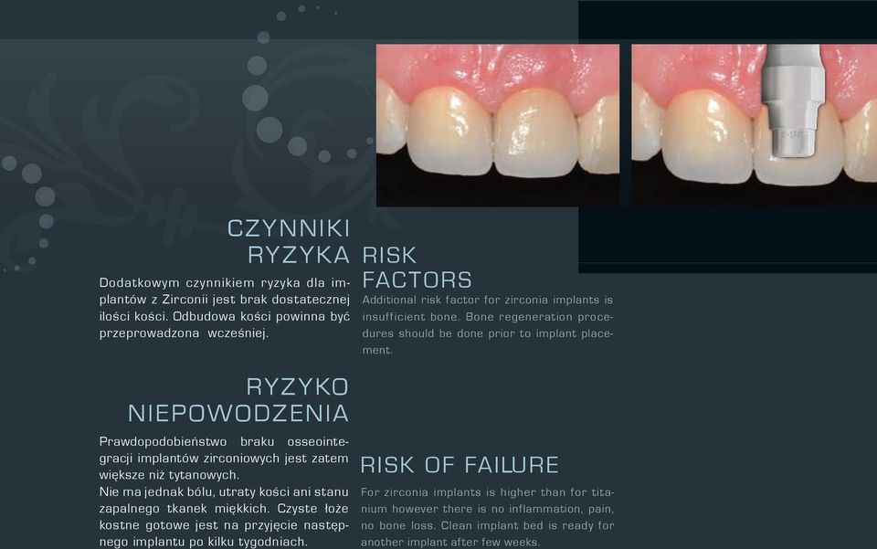 RYZYKO NIEPOWODZENIA Prawdopodobieństwo braku osseointegracji implantów zirconiowych jest zatem większe niż tytanowych. Nie ma jednak bólu, utraty kości ani stanu zapalnego tkanek miękkich.