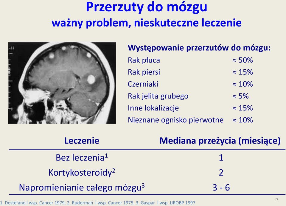 10% Leczenie Mediana przeżycia (miesiące) Bez leczenia 1 1 Kortykosteroidy 2 2 Napromienianie całego