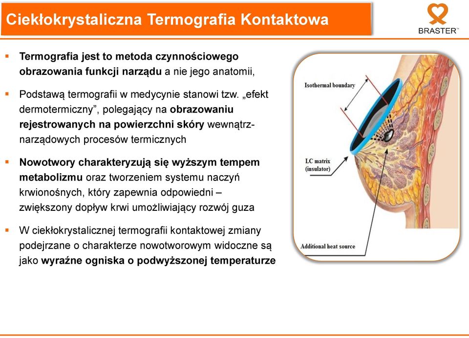 efekt dermotermiczny, polegający na obrazowaniu rejestrowanych na powierzchni skóry wewnątrznarządowych procesów termicznych Nowotwory charakteryzują się