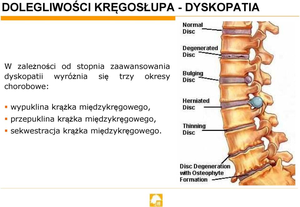 okresy chorobowe: wypuklina krążka międzykręgowego,