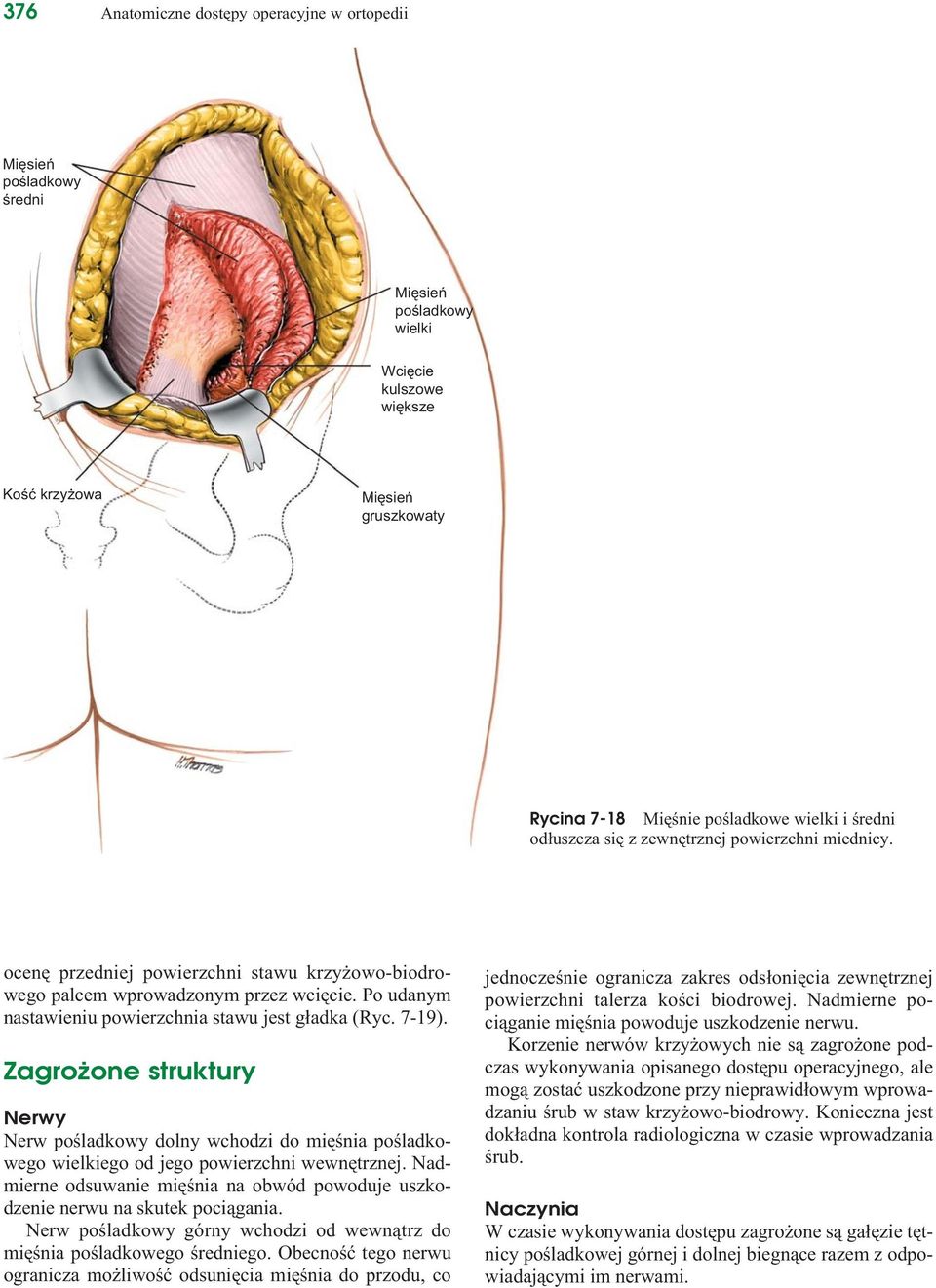 Zagrożone struktury Nerwy Nerw pośladkowy dolny wchodzi do mięśnia pośladkowego wielkiego od jego powierzchni wewnętrznej.