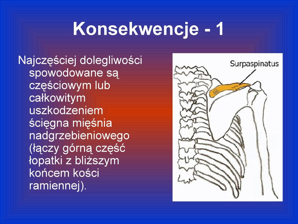 uszkodzeniem ścięgna mięśnia nadgrzebieniowego