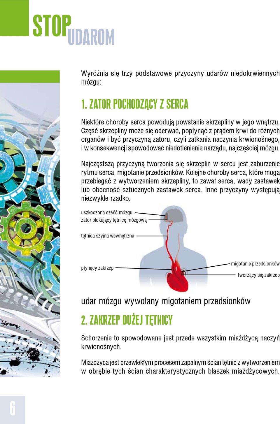 najczęściej mózgu. Najczęstszą przyczyną tworzenia się skrzeplin w sercu jest zaburzenie rytmu serca, migotanie przedsionków.