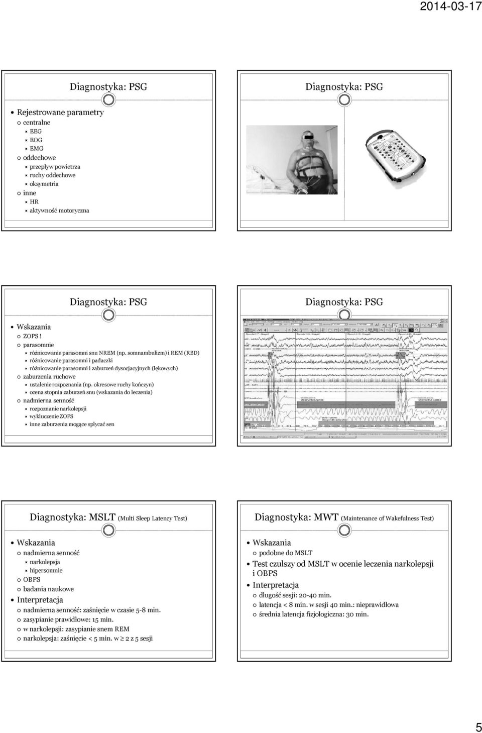 okresowe ruchy kończyn) ocena stopnia zaburzeń snu (wskazania do leczenia) nadmierna senność rozpoznanie narkolepsji wykluczenie ZOPS inne zaburzenia mogące spłycać sen Diagnostyka: MSLT (Multi Sleep