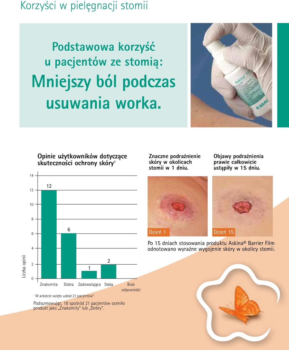 dniach stosowania produktu Askina Barrier Film ych substancji odnotowano jakiegokolwiek wyraźne wygojenie środka do usuwania skóry w okolicy medycznych stomii.