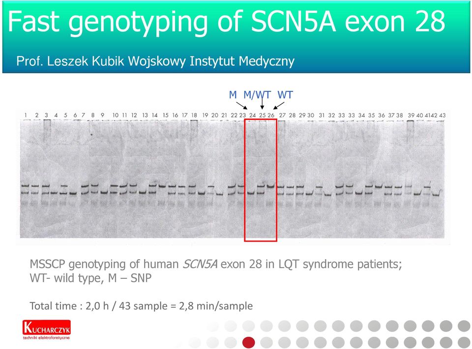 genotyping of human SCN5A exon 28 in LQT syndrome