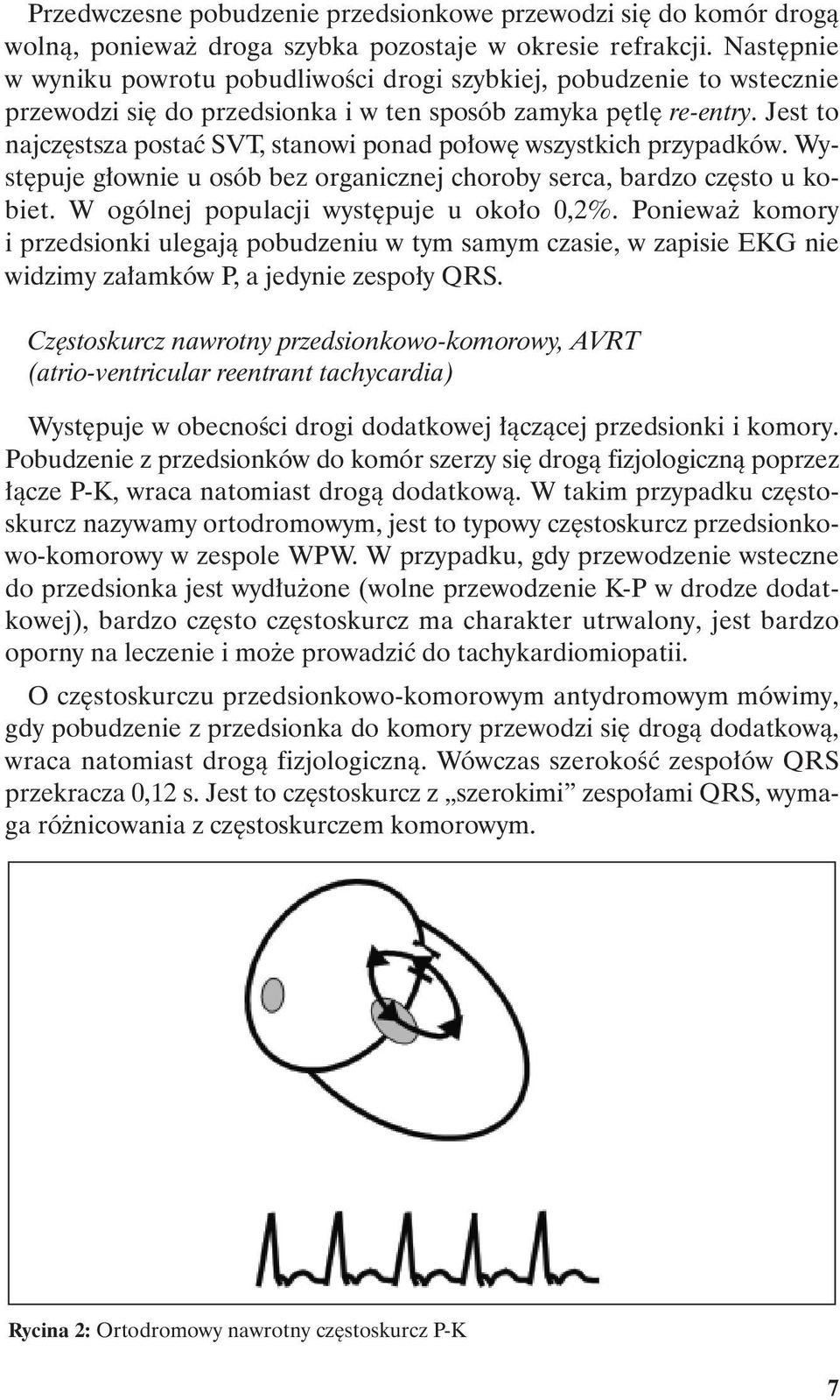 Jest to najczęstsza postać SVT, stanowi ponad połowę wszystkich przypadków. Występuje głownie u osób bez organicznej choroby serca, bardzo często u kobiet. W ogólnej populacji występuje u około 0,2%.