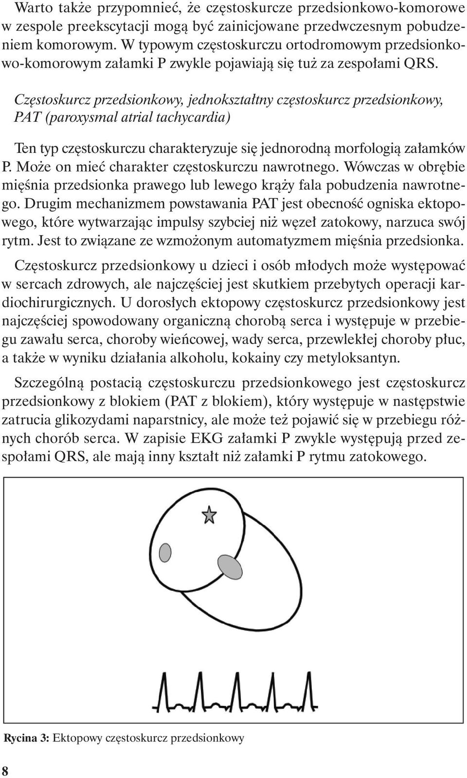 Częstoskurcz przedsionkowy, jednokształtny częstoskurcz przedsionkowy, PAT (paroxysmal atrial tachycardia) Ten typ częstoskurczu charakteryzuje się jednorodną morfologią załamków P.