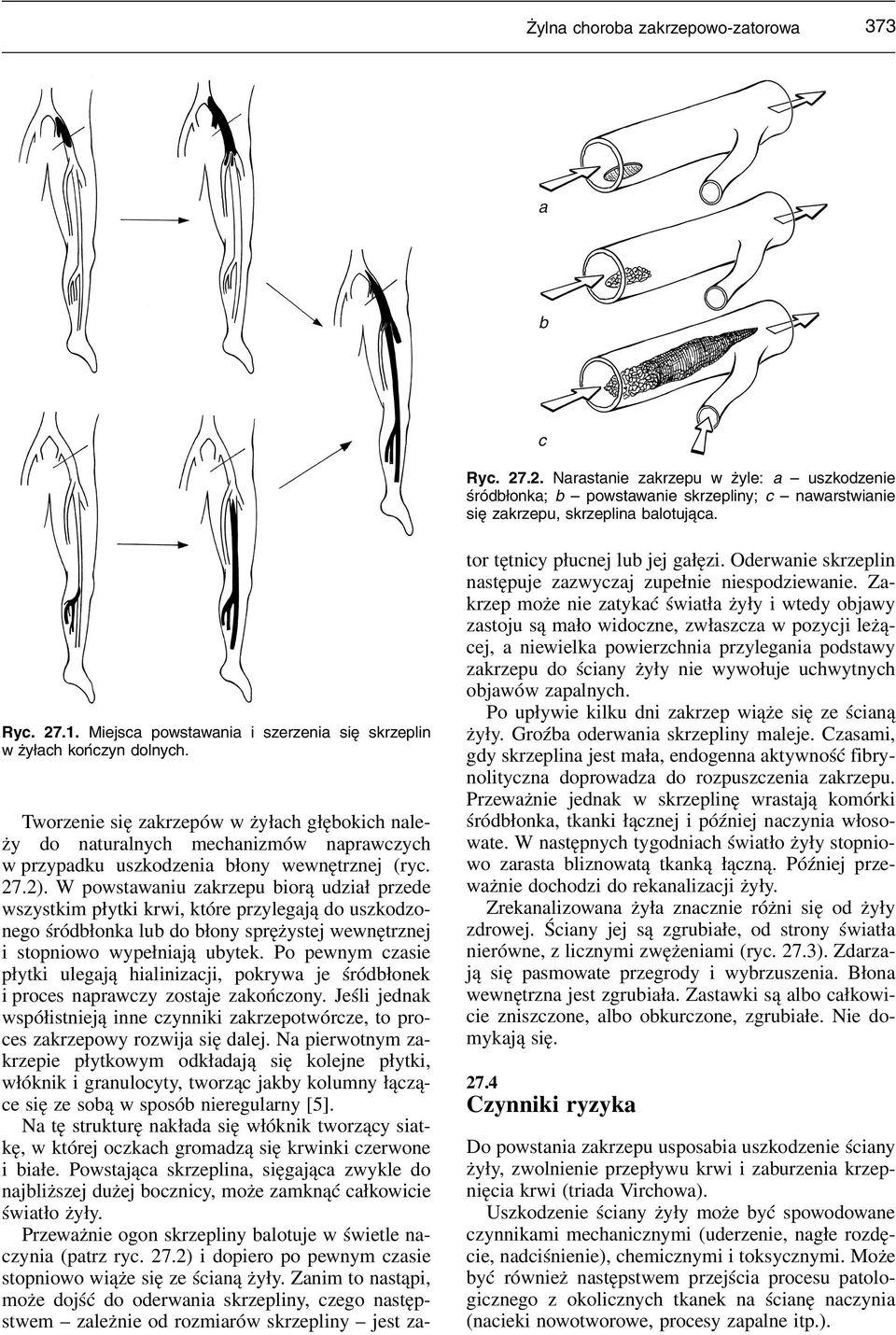 Tworzenie się zakrzepów w żyłach głębokich należy do naturalnych mechanizmów naprawczych w przypadku uszkodzenia błony wewnętrznej (ryc. 27.2).