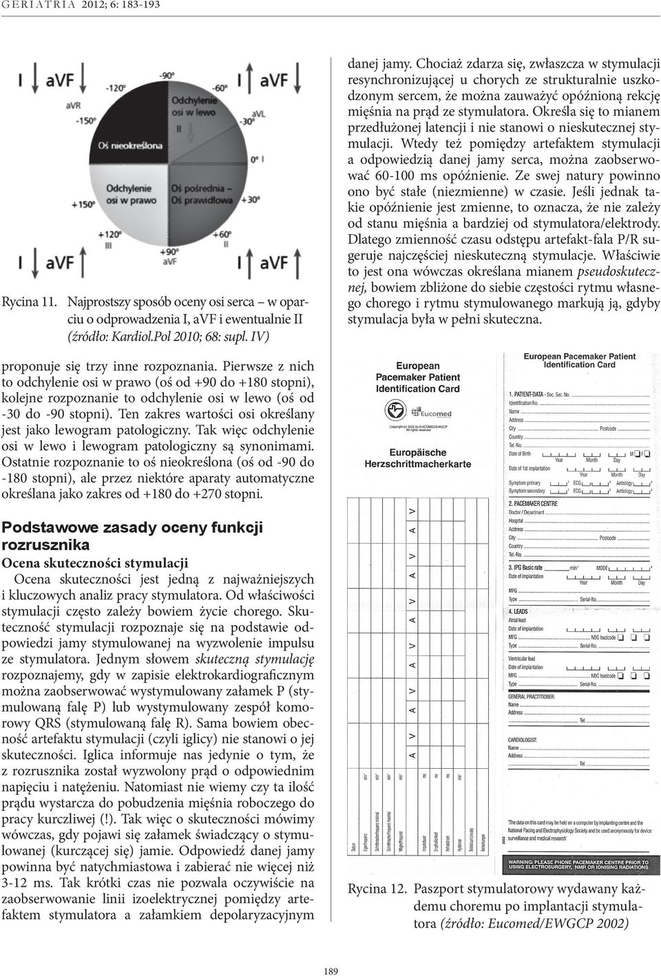 Określa się to mianem przedłużonej latencji i nie stanowi o nieskutecznej stymulacji. Wtedy też pomiędzy artefaktem stymulacji a odpowiedzią danej jamy serca, można zaobserwować 60-100 ms opóźnienie.