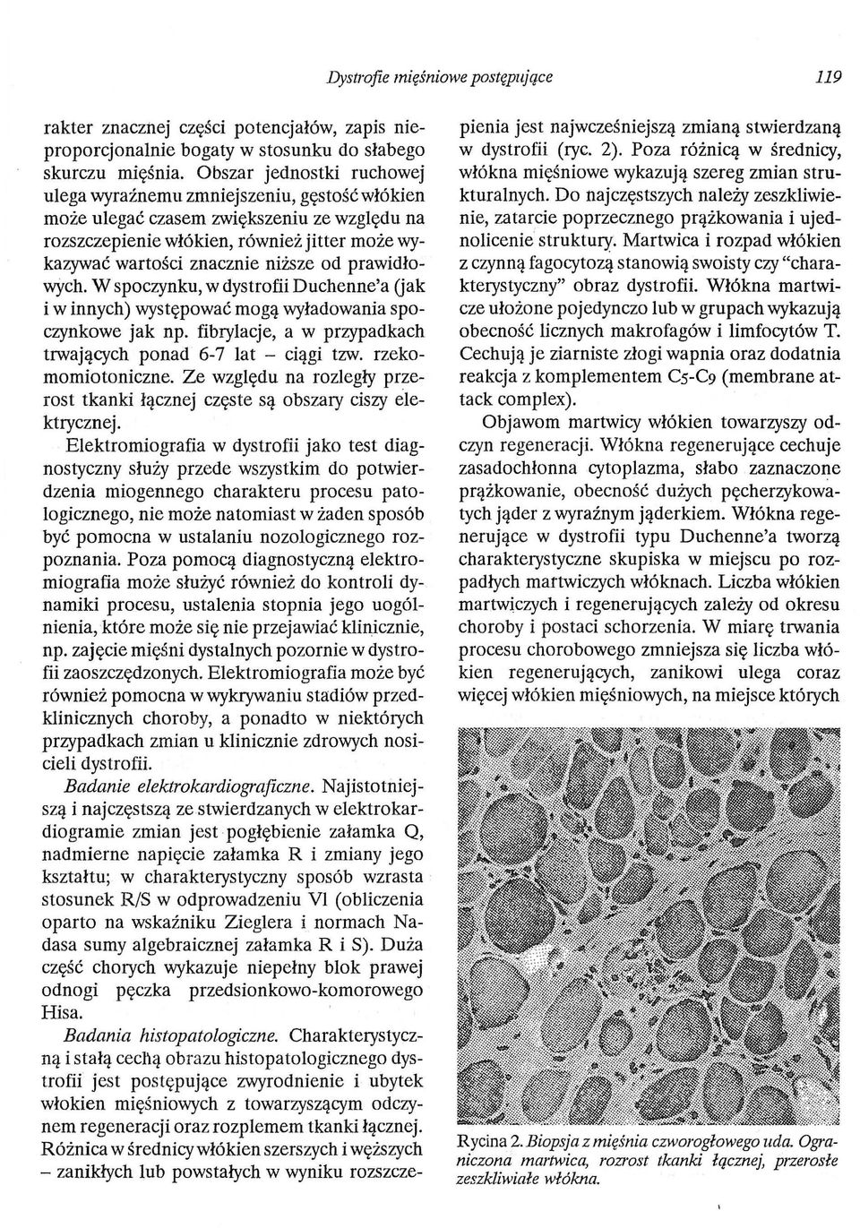 prawidłowych. W spoczynku, w dystrofii Duchenne'a Gak i w innych) występować mogą wyładowania spoczynkowe jak np. fibrylacje, a w przypadkach trwających ponad 6-7 lat - ciągi tzw. rzekomomiotoniczne.