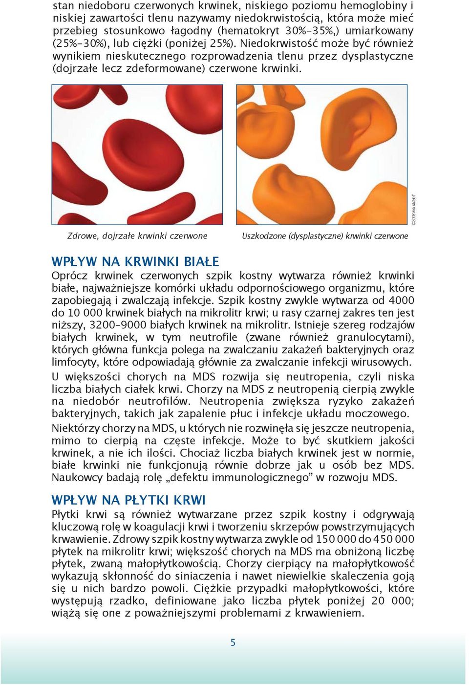 2008 Kirk Moldoff Zdrowe, dojrzałe krwinki czerwone Uszkodzone (dysplastyczne) krwinki czerwone WPŁYW NA KRWINKI BIAŁE Oprócz krwinek czerwonych szpik kostny wytwarza również krwinki białe,