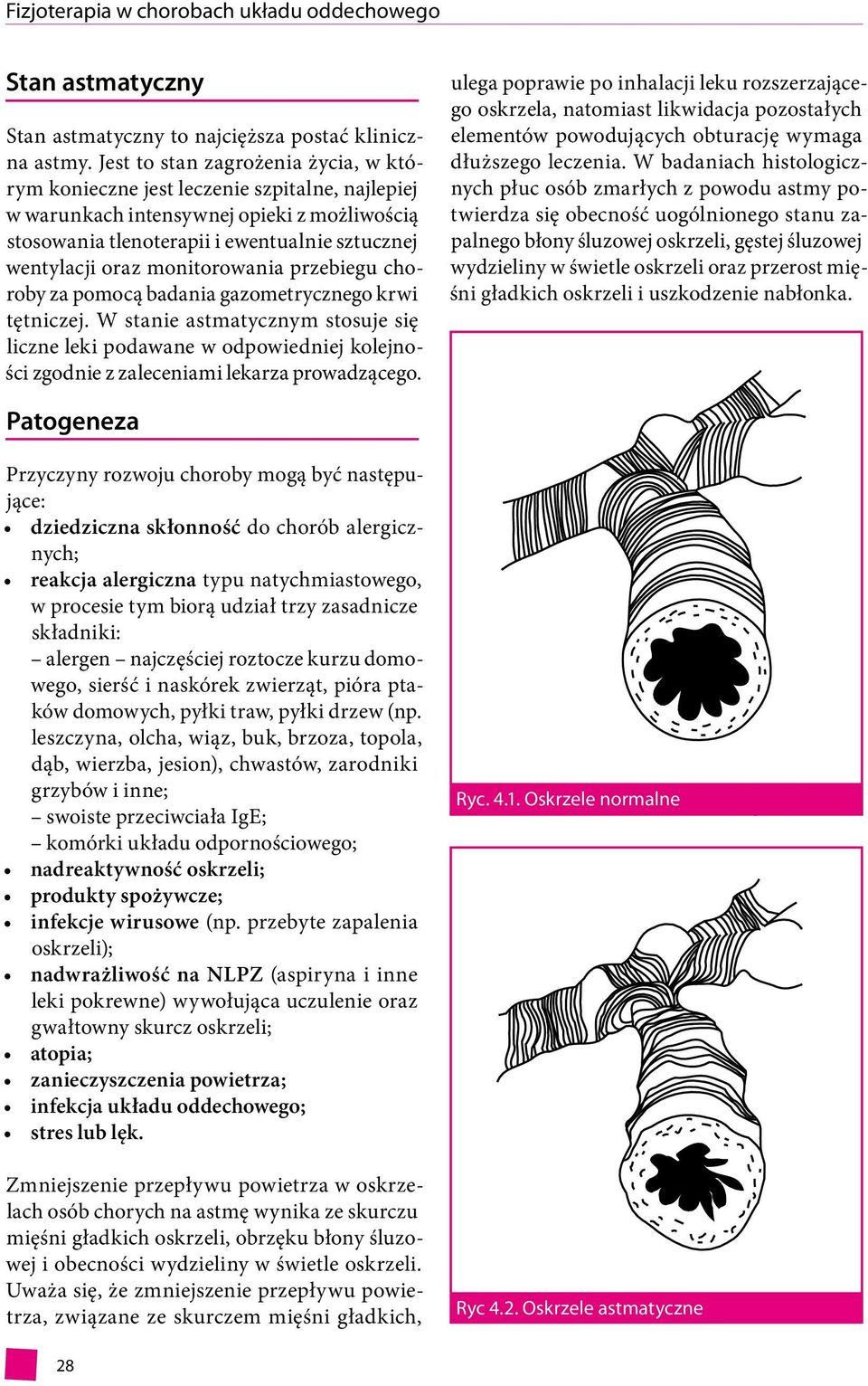 monitorowania przebiegu choroby za pomocą badania gazometrycznego krwi tętniczej.