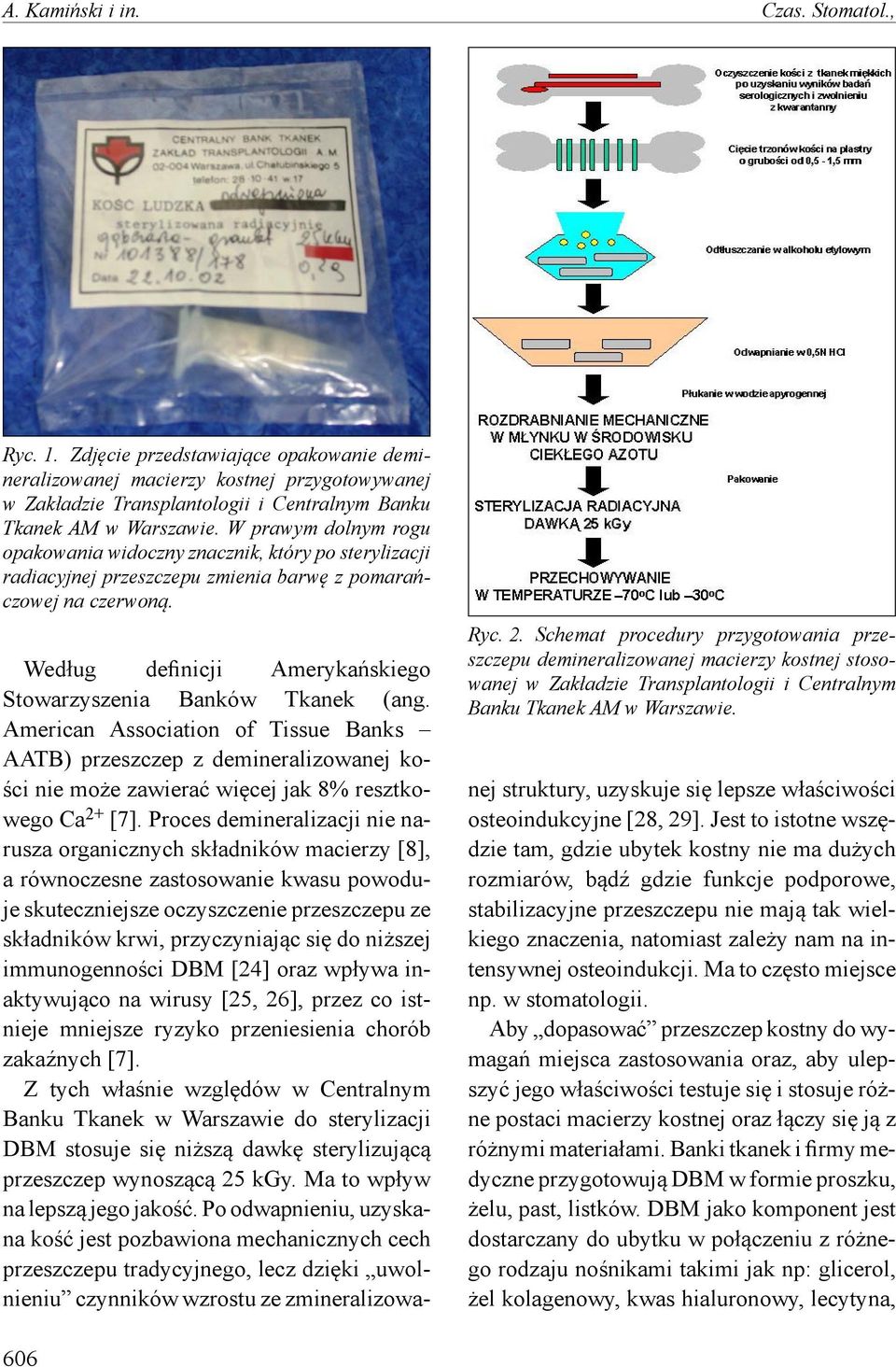 Schemat procedury przygotowania przeszczepu demineralizowanej macierzy kostnej stosowanej w Zakładzie Transplantologii i Centralnym Banku Tkanek AM w Warszawie.