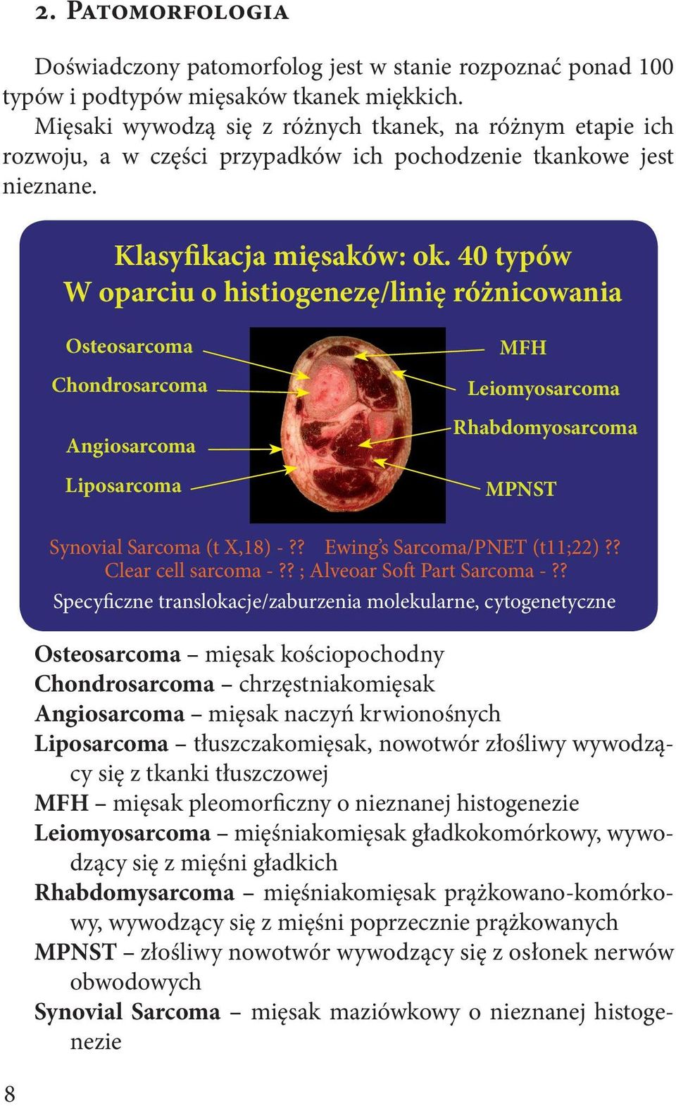 40 typów W oparciu o histiogenezę/linię różnicowania Osteosarcoma Chondrosarcoma Angiosarcoma Liposarcoma MFH Leiomyosarcoma Rhabdomyosarcoma MPNST Synovial Sarcoma (t X,18) -?