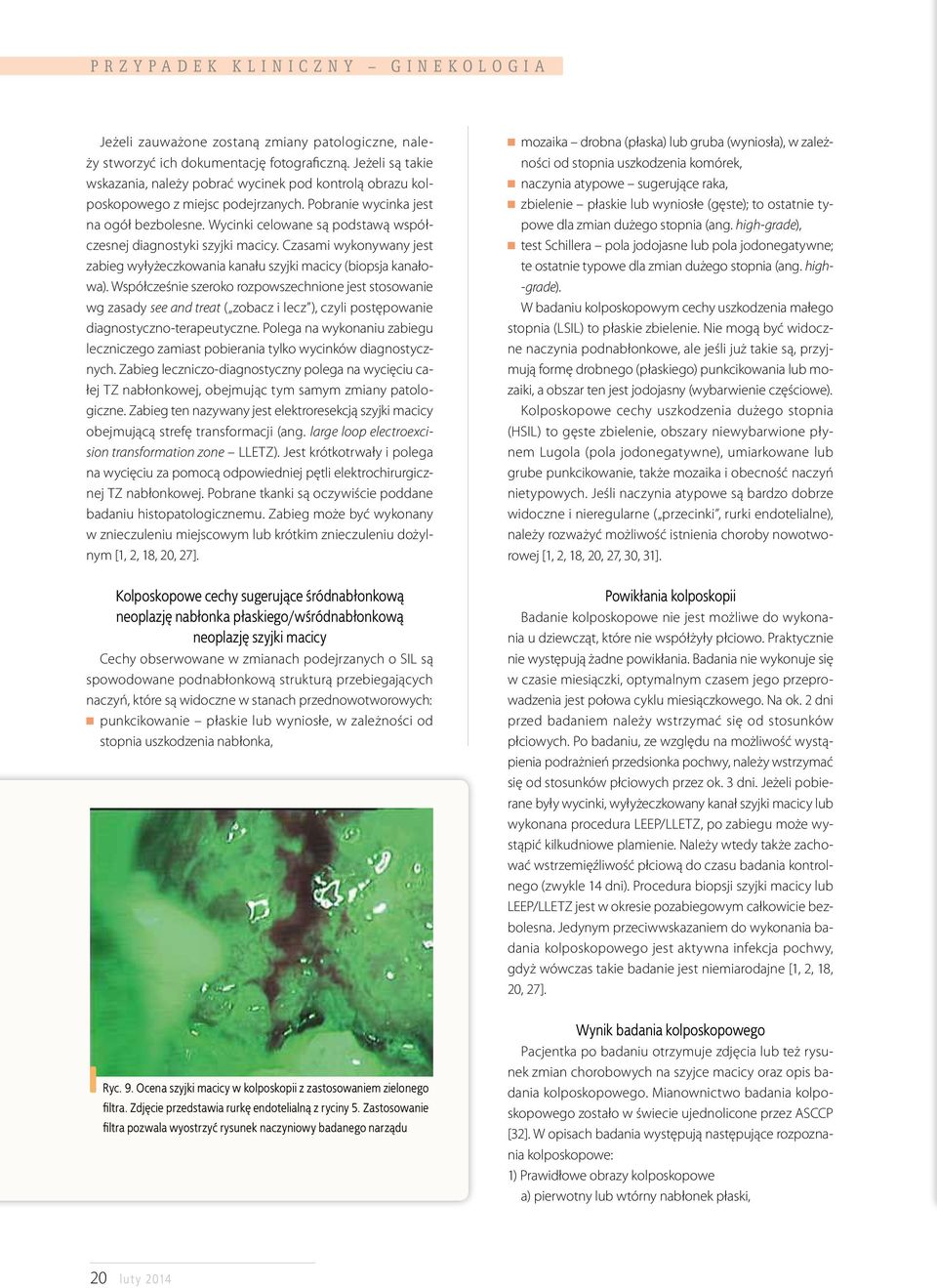 Wycinki celowane są podstawą współczesnej diagnostyki szyjki macicy. Czasami wykonywany jest zabieg wyłyżeczkowania kanału szyjki macicy (biopsja kanałowa).