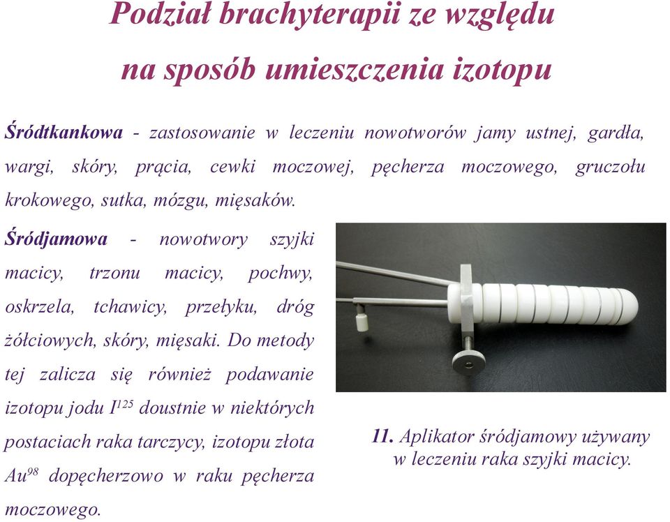 Śródjamowa macicy, - trzonu nowotwory macicy, szyjki pochwy, oskrzela, tchawicy, przełyku, dróg żółciowych, skóry, mięsaki.
